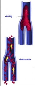 Kattints ide ha szeretn�d l�tni a k�pet